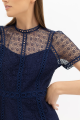 Lace Mini Dress Rent B